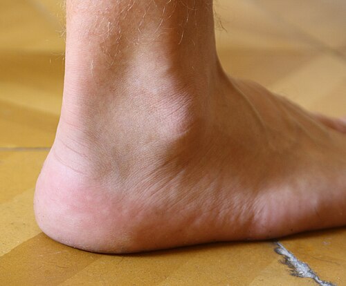 ankle