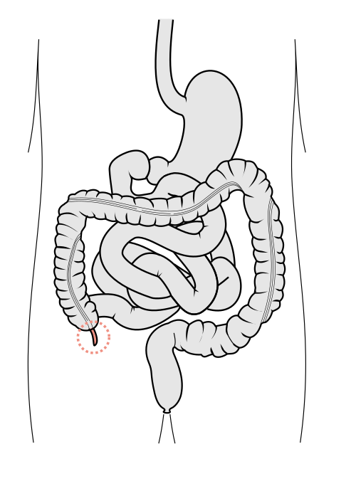 appendix