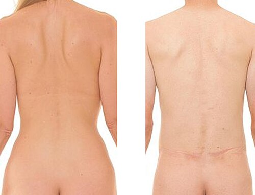 back