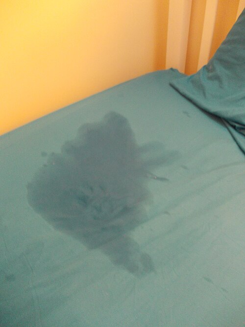 bedwetting