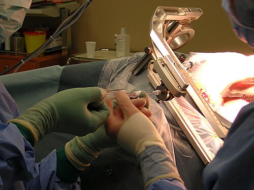 biopsy