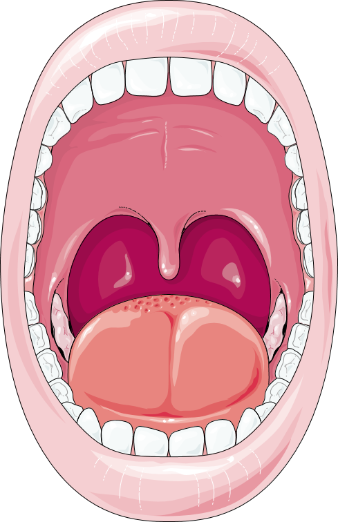 cavity