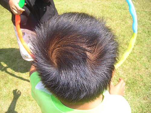cowlick