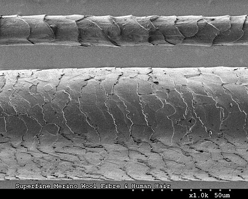 cuticle