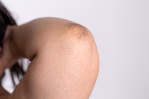 elbow