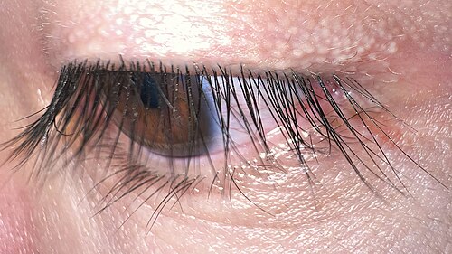 eyelash