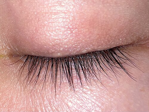 eyelid