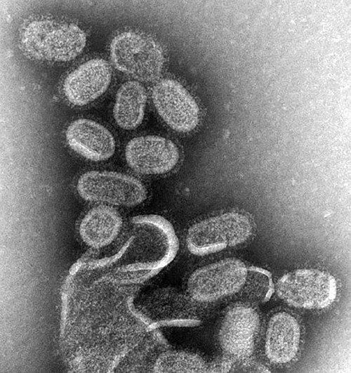 flu