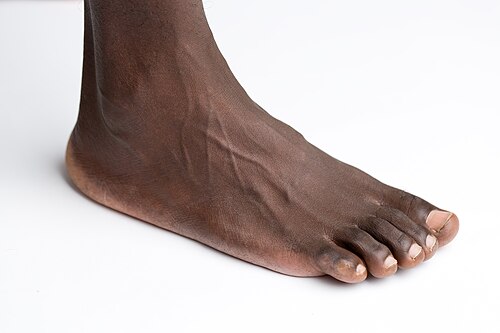 foot