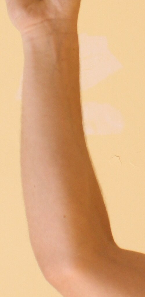forearm