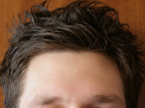 hairline