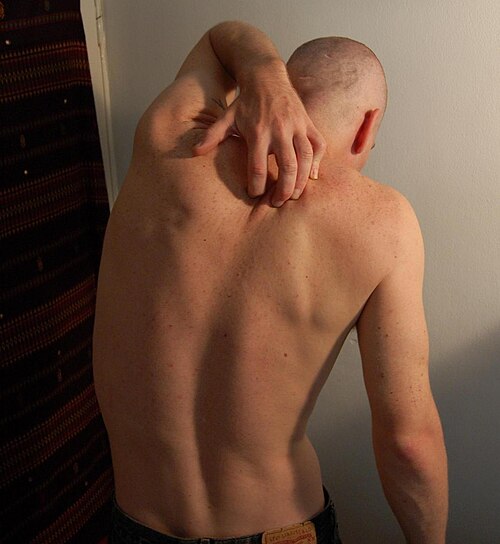 itch