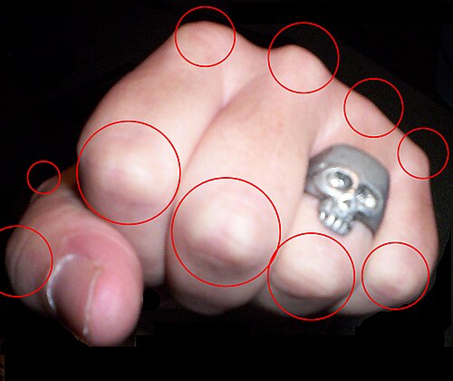 knuckle