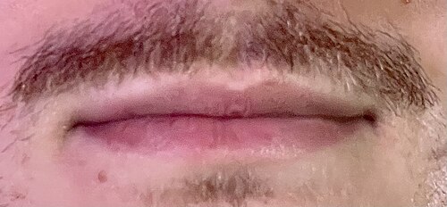 lip