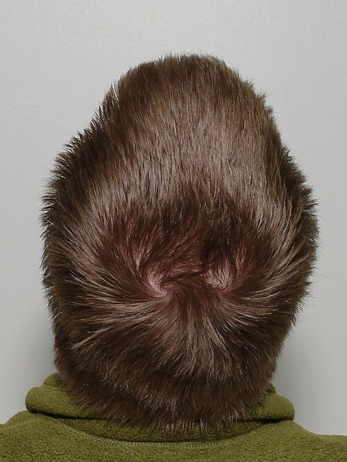 scalp