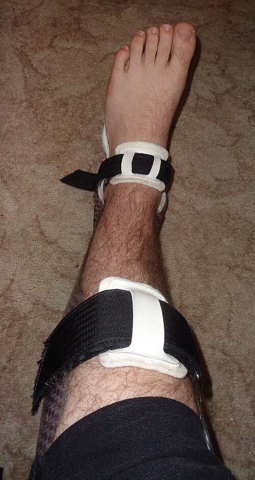 splint