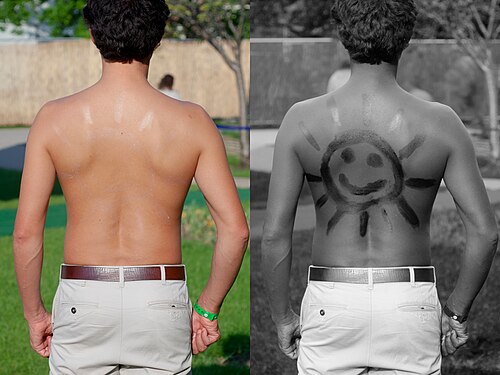sunblock