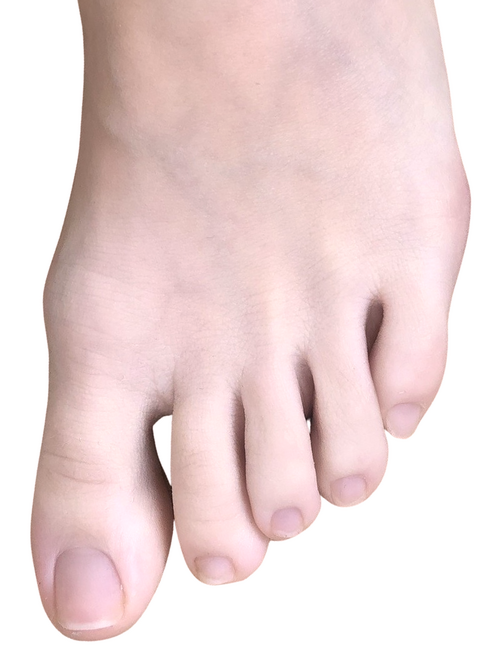 toe
