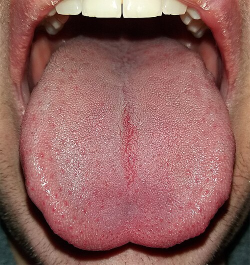 tongue
