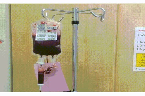 transfusion