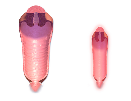 vaginal