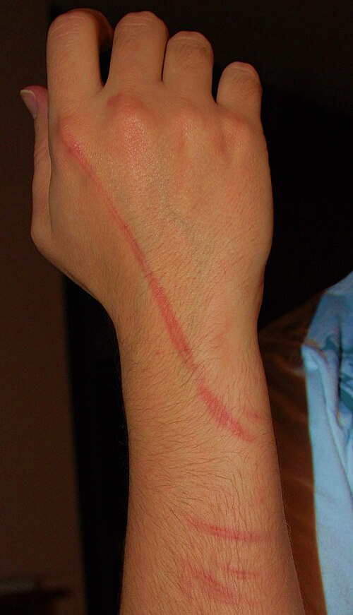 welt